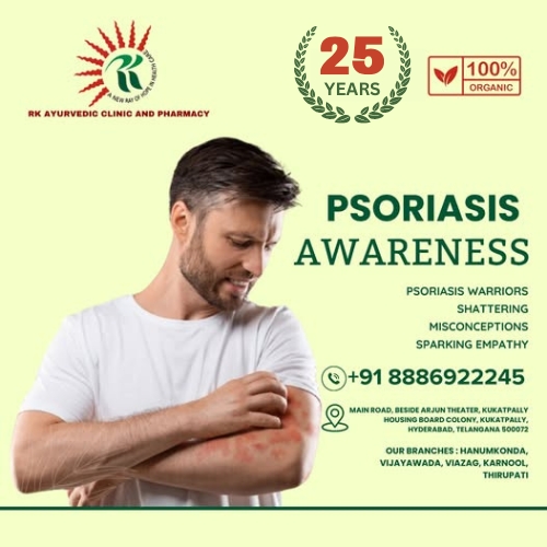 Best ayurvedic treatment for psoriasis