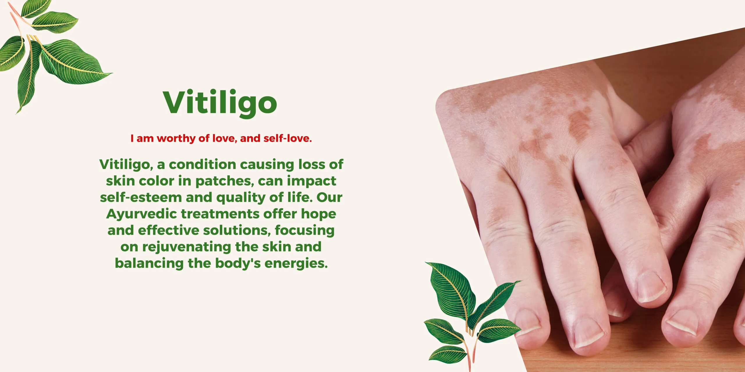 Ayurvedic treatment for vitiligo skin condition