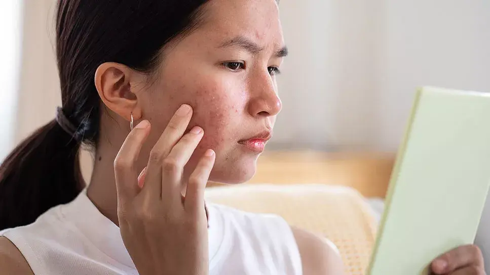 The Benefits of Herbal Remedies for Skin Conditions