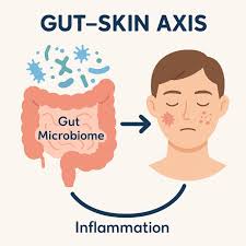 The Importance of Gut Health in Skin Conditions
